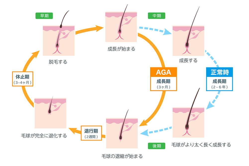 ヘアサイクルの図解