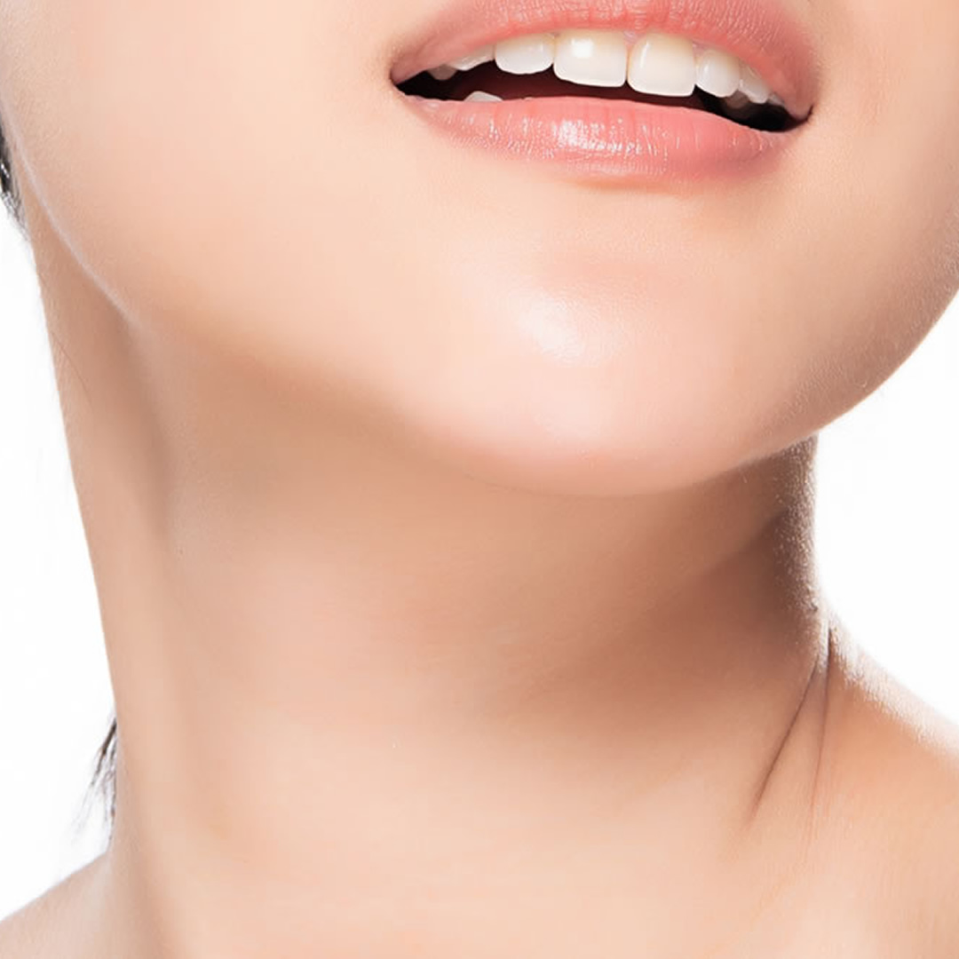 ネフェルティティリフトのイメージ