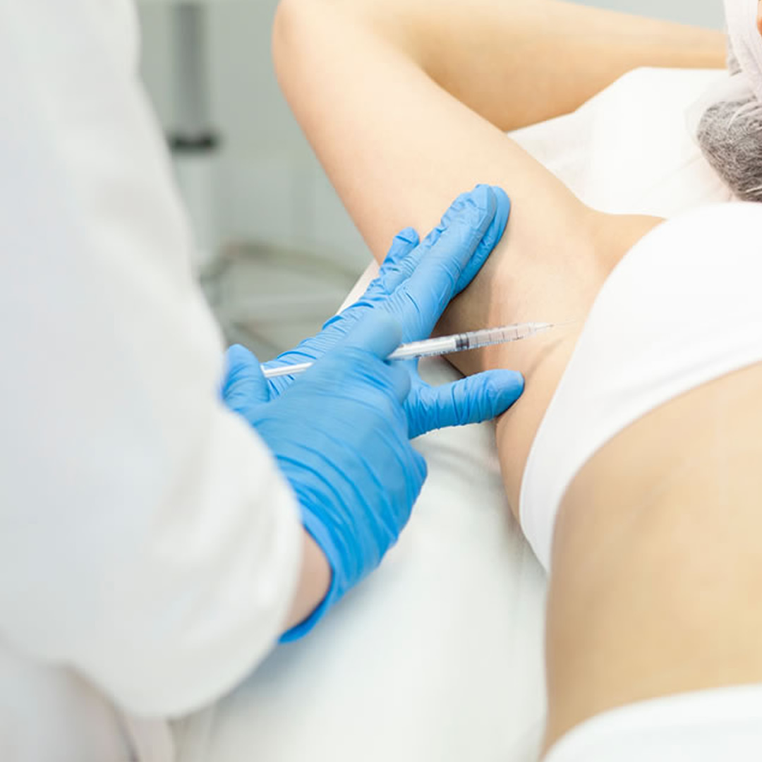 ワキガボトックスのイメージ